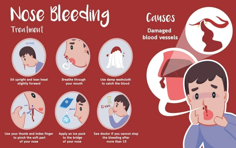 What Does Nose Bleeding Symbolize?